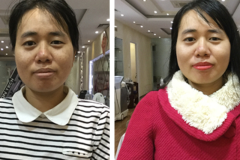 Before After - 3